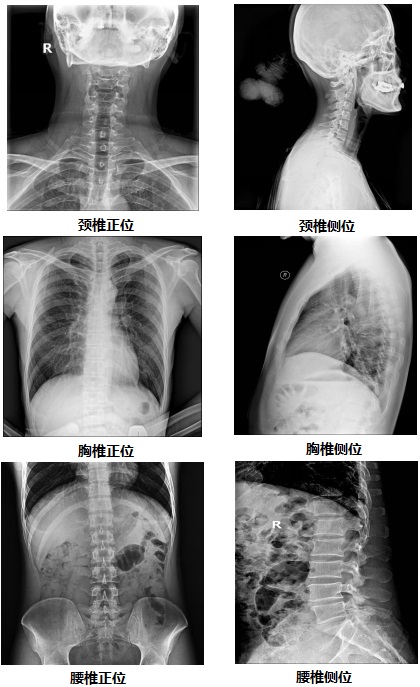 國(guo)産(chan)無線(xiàn)懸吊dr部(bu)分(fēn)臨牀(chuang)效果圖